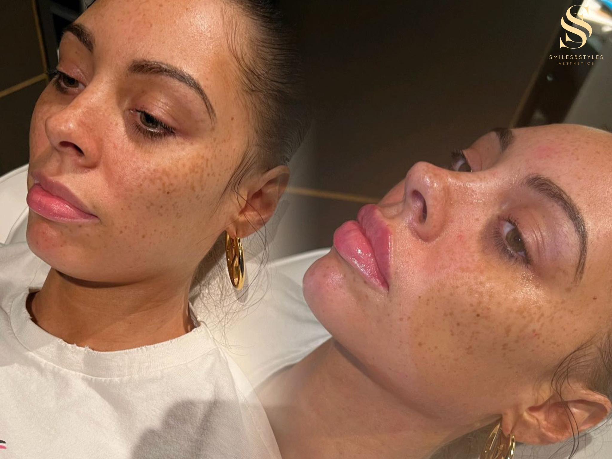 Foto portada Facial